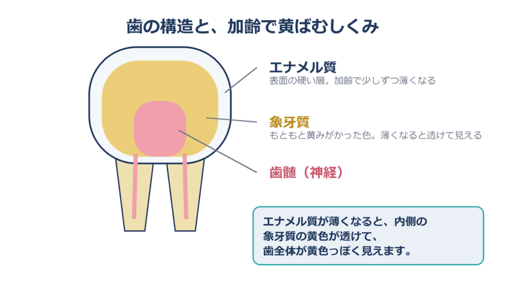 歯の断面図 エナメル質 象牙質 加齢で黄ばむしくみ
