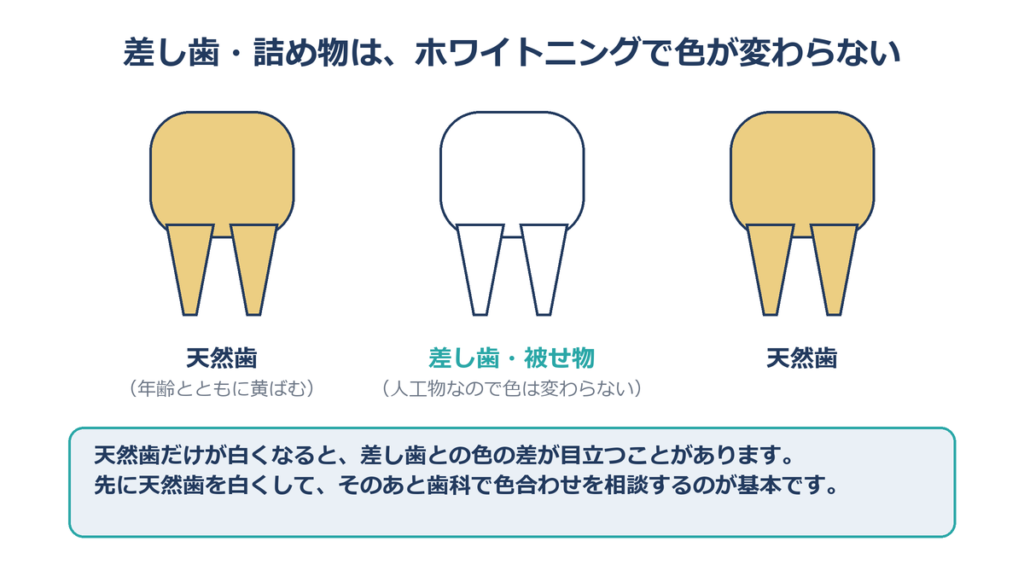 差し歯 被せ物は人工物 ホワイトニングで色が変わらない 天然歯との色の差